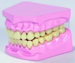 Макет на  зъби